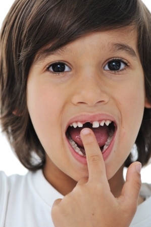 Ouders weten te weinig over tandzorg bij kinderen